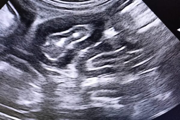 Abdomen and chest ultrasound of dog at veterinary practice in Hastings, East Sussex
